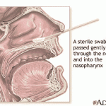 Instructions for NP swabs