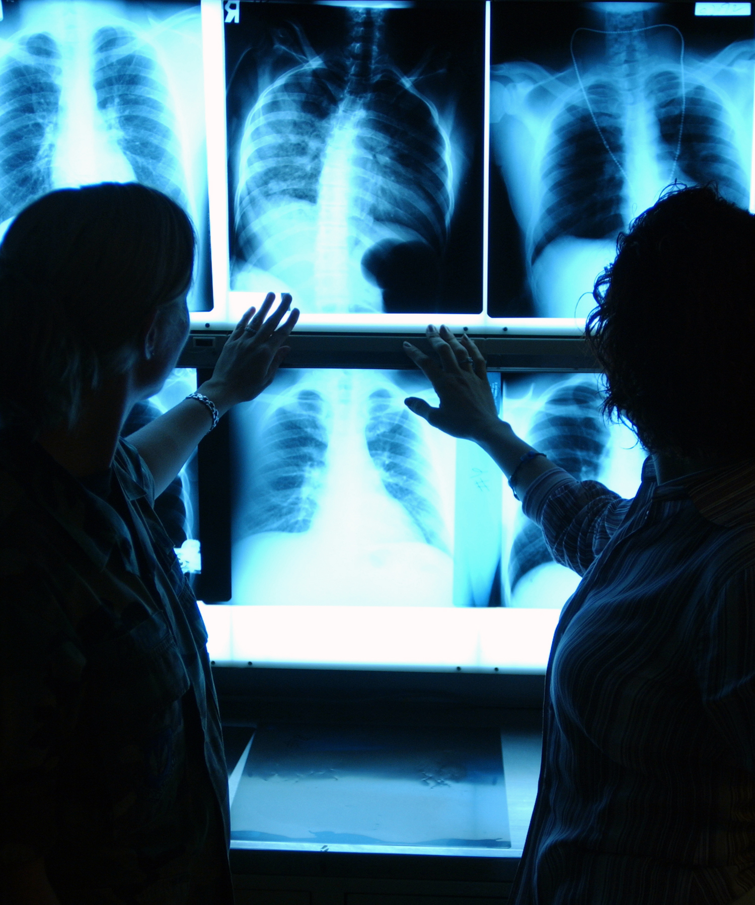 Who is the Better Radiologist? British Columbia Respiratory Therapy